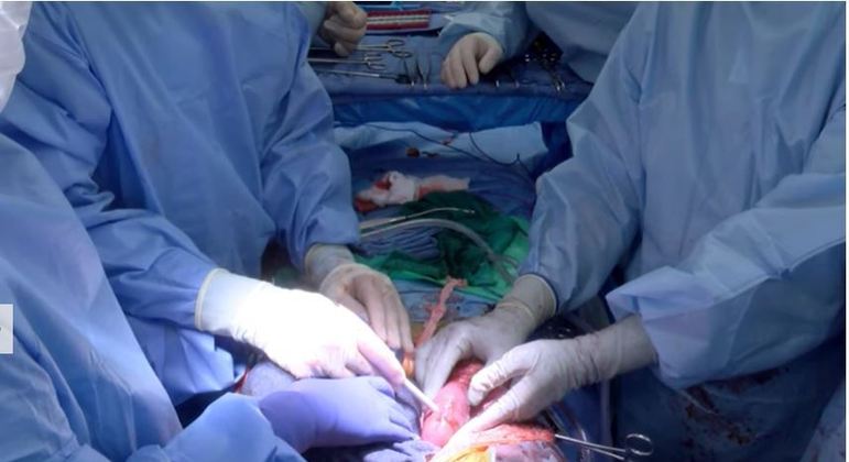 Morre homem que recebeu transplante de coração de porco