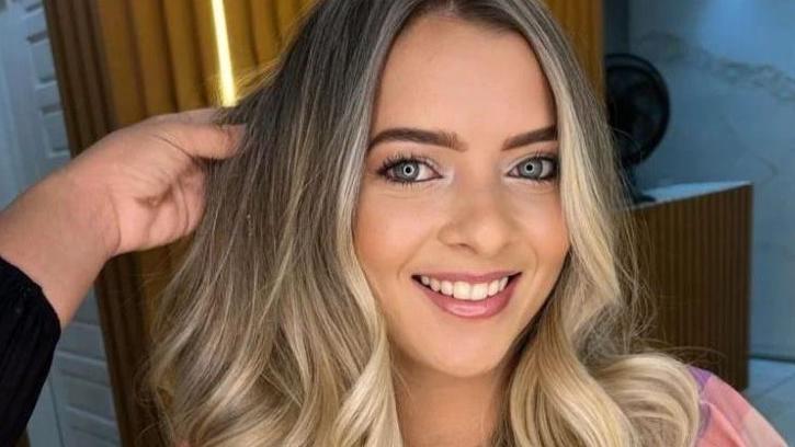 Mulher teve 80% do corpo queimado pelo ex-namorado