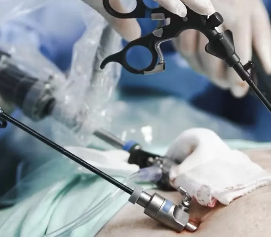 Paraíba é 1° lugar em número de cirurgias bariátricas realizadas pelo SUS na região Nordeste