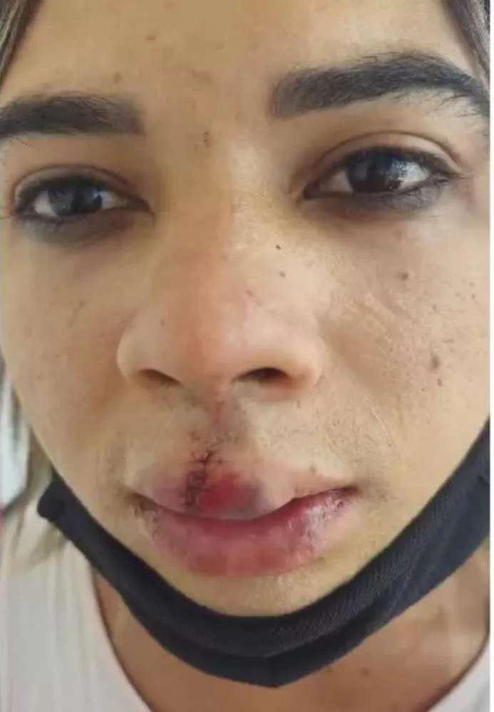 Mulher trans denuncia agressão em choperia de Cajazeiras (Foto: Divulgação)