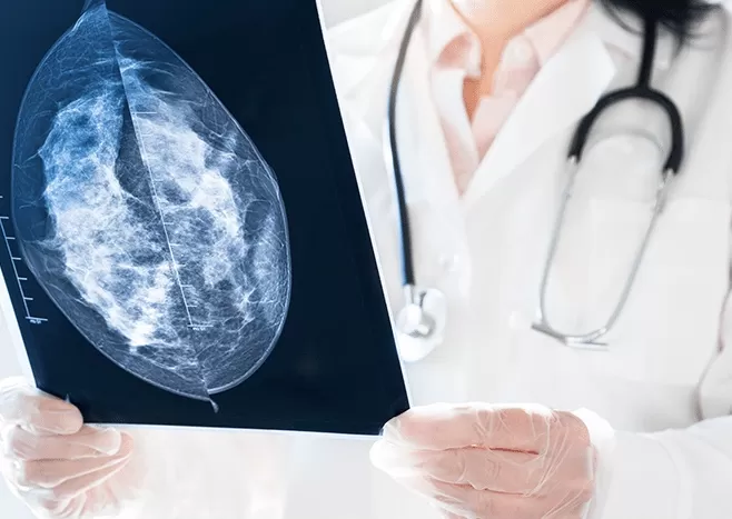 Prefeitura de São João do Rio do Peixe promove Mutirão de Mamografia