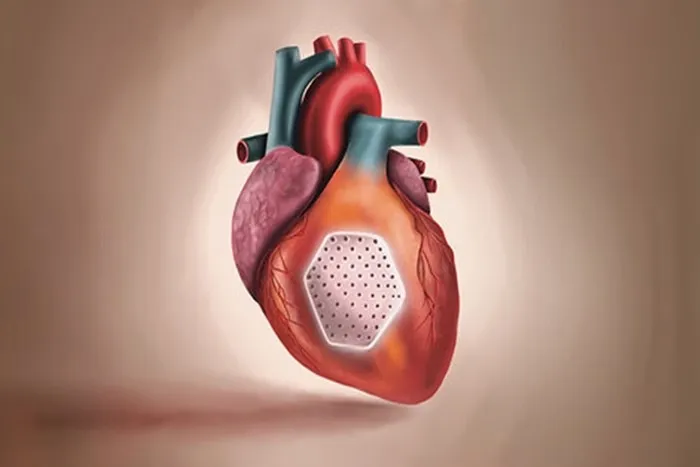 Insuficiência Cardíaca: Adesivo de células-tronco pode regenerar órgão