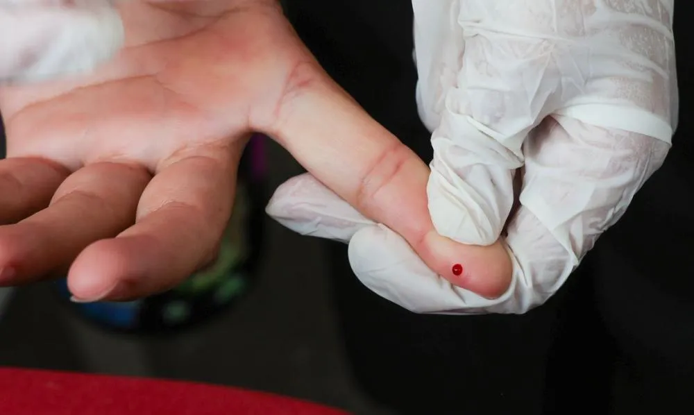 SUS passa a oferecer teste rápido de dengue|Foto: Fabio Rodrigues-Pozzebom/Agência Brasil